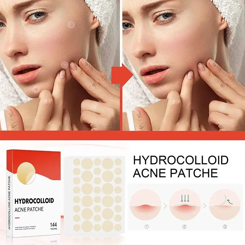 144pcs/set Face Skin Care Acne Pimple Patch 2 Sizes Invisible