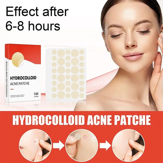 144pcs/set Face Skin Care Acne Pimple Patch 2 Sizes Invisible